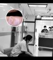 小孩白斑早期症状图片大全高清