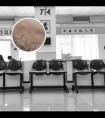 搜一下他克莫司软膏的作用