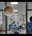 308激光分子白癜风光疗仪